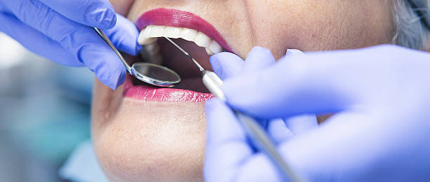 Best Emergency Dentist for Lost Fillings or Crowns in Enterprise, AL